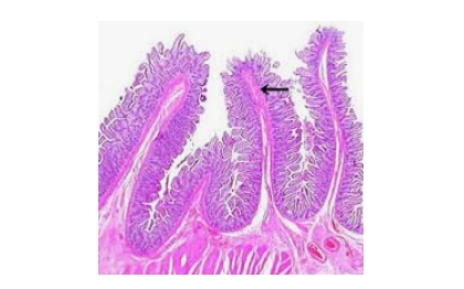 Villi of the small intestine